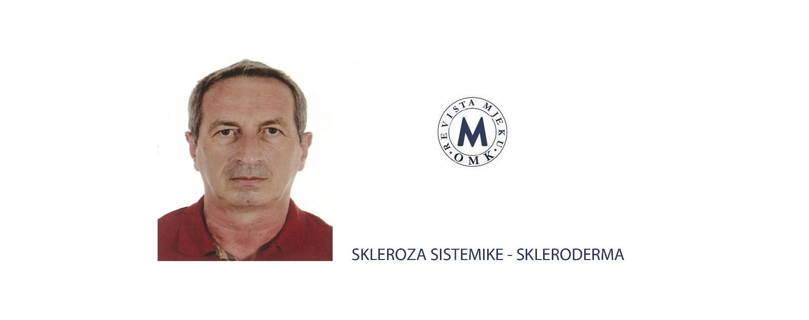 Afrim Gashi Skleroza Sistemike Skleroderma Oda E Mjekëve Te Kosovës